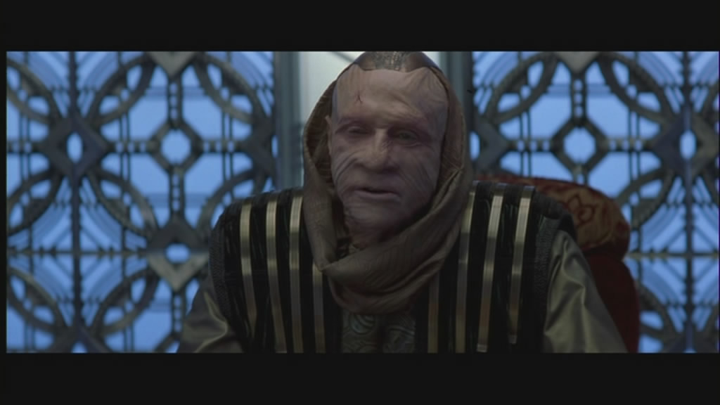 The result of toomuch Botox.