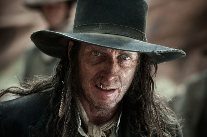 Oh, there's no dental plan in the Wild West, sunshine!!